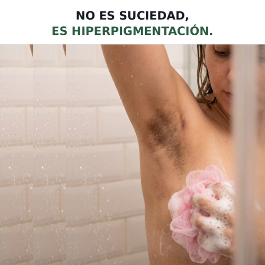 Nuestra Solución Total para las manchas oscuras en la Piel