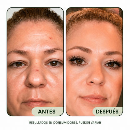 Crema Aclaradora (Aclarado + regeneración)