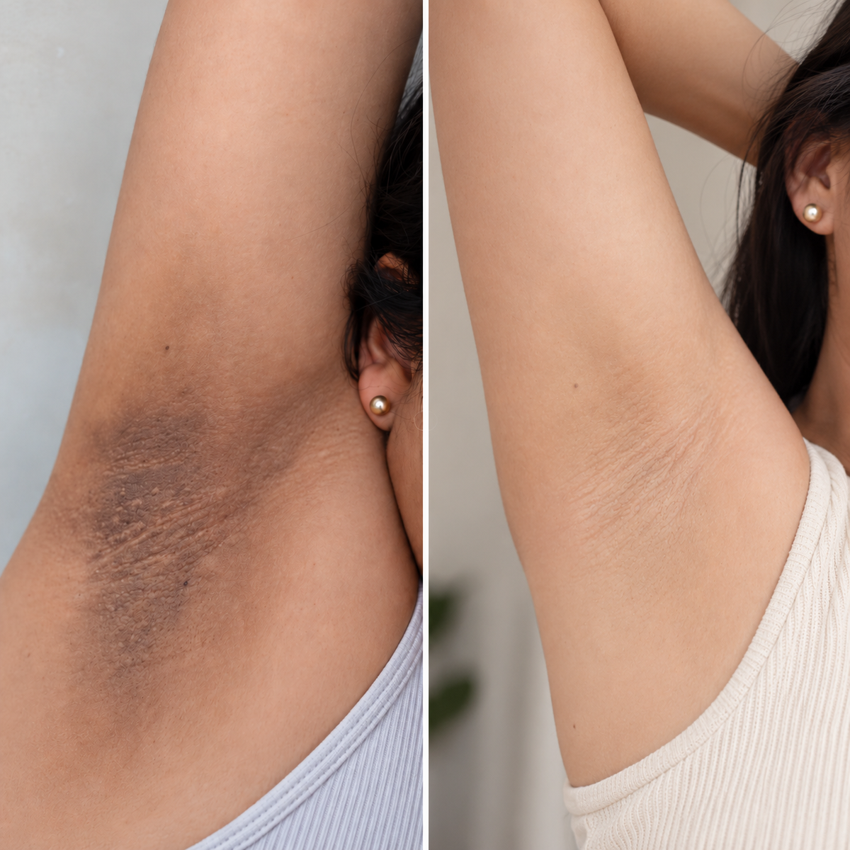 Pads Aclarantes para Manchas Oscuras Clenora