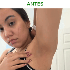 Discos Elimina Manchas - Clenora™