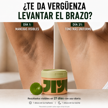 Clenora Glow Pads – Discos Aclarantes para Manchas Oscuras