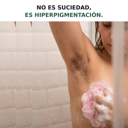 Nuestra Solución Total para las manchas oscuras en la Piel